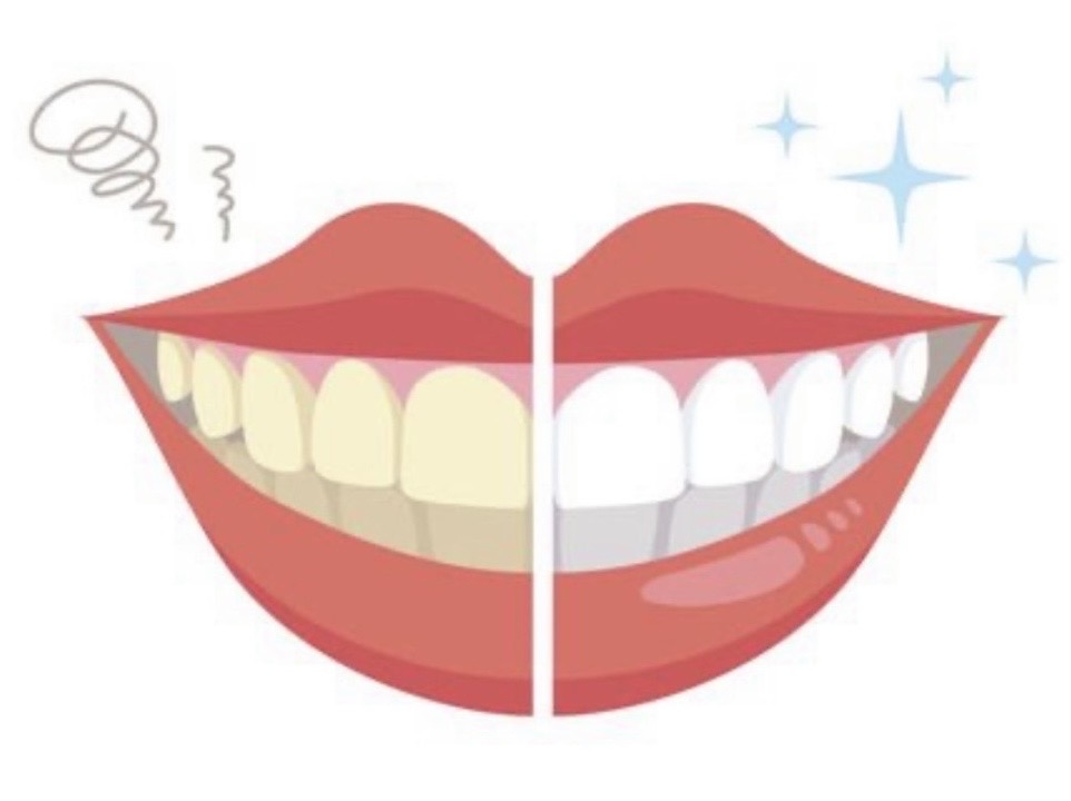 医療ホワイトニングと非医療ホワイトニングの違いについて🦷✨