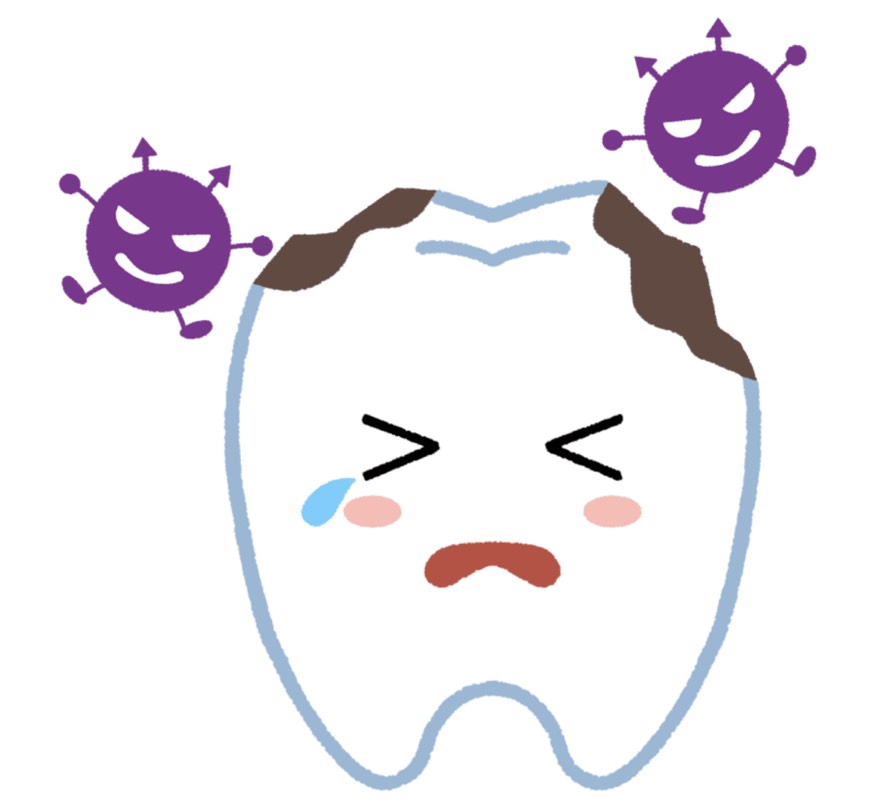 虫歯はなぜできる？虫歯ができる4つの原因